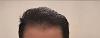 Click image for larger version.&nbsp;

Name:	hair32.jpg&nbsp;
Views:	20148&nbsp;
Size:	53.7 KB&nbsp;
ID:	29